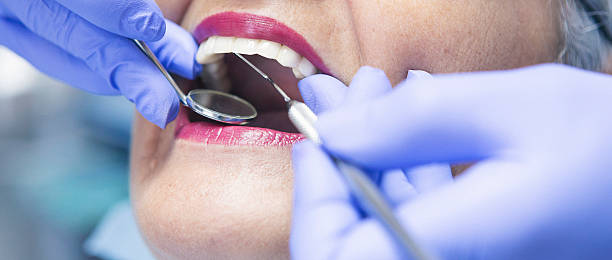 Best Emergency Dental Care for Broken or Chipped Teeth in Crestline, OH